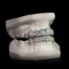 Opal Iced Out Grillz