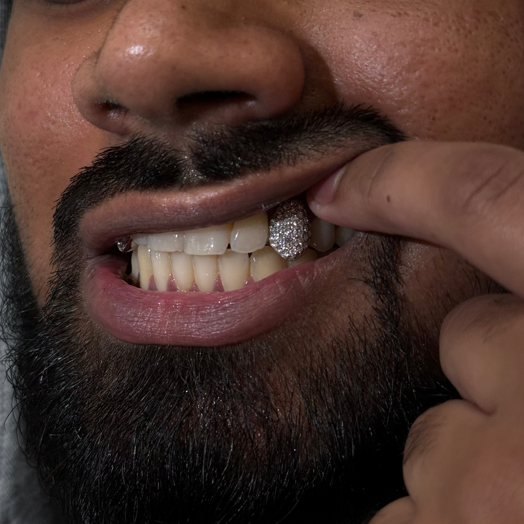 2 Diamond Caps | Honeycomb Setting