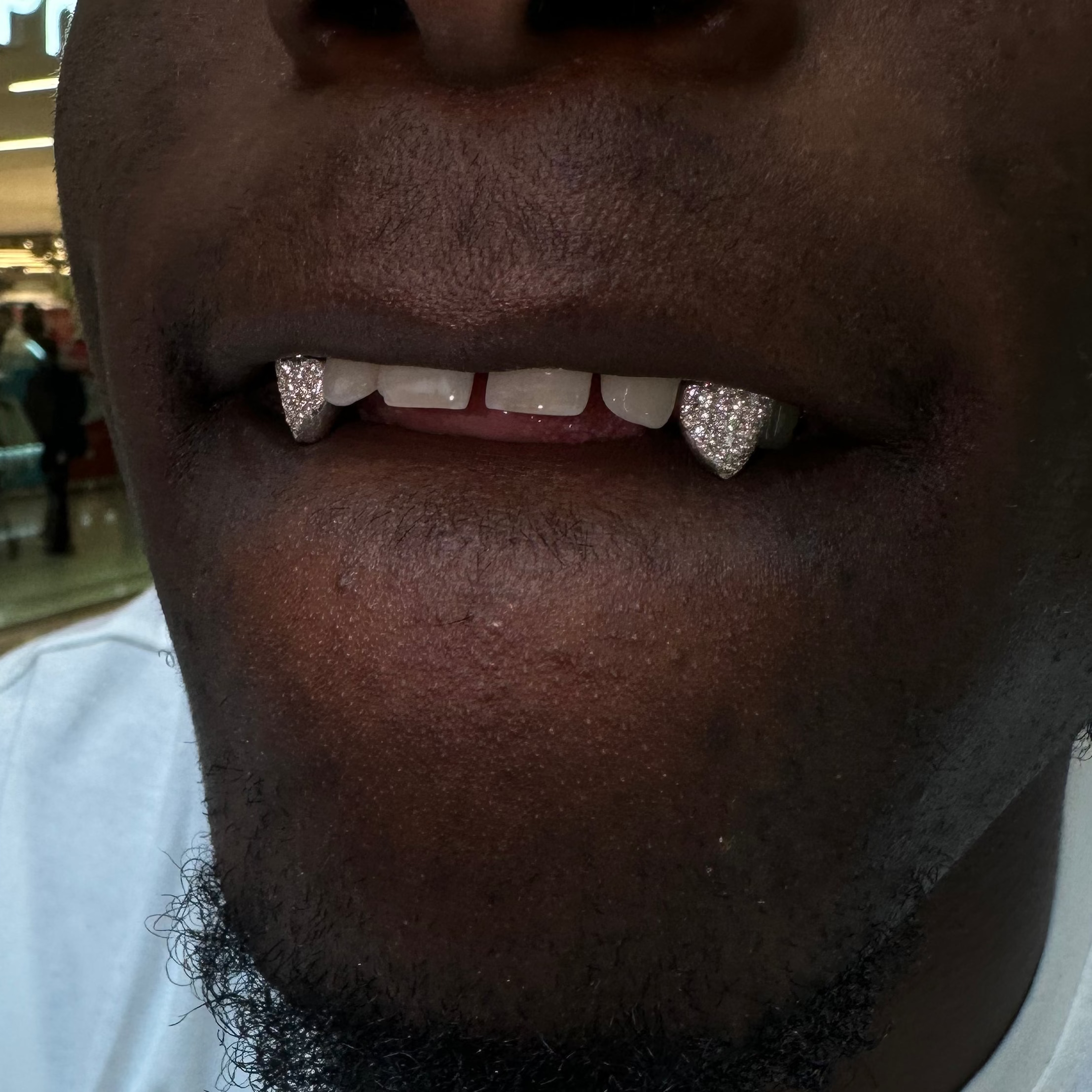 2 Diamond Caps | Honeycomb Setting