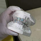 Opal Iced Out Grillz